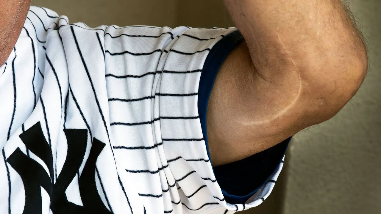 Baseball Reaches Its Breaking Point